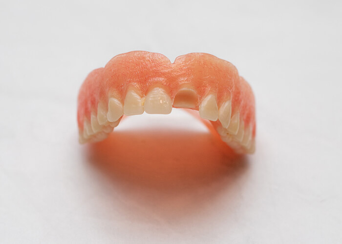 Denture Missing Tooth
